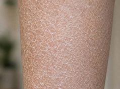 My skin looks white, scaly, and ashy no matter how much lotion I use — what can I do?