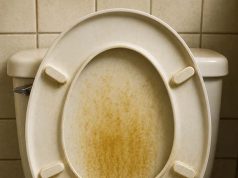 Any miracle cleaners or tricks before I replace whole seat?