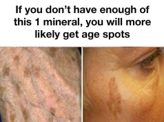 If you don’t have enough of this 1 mineral, you’ll more likely get age spots